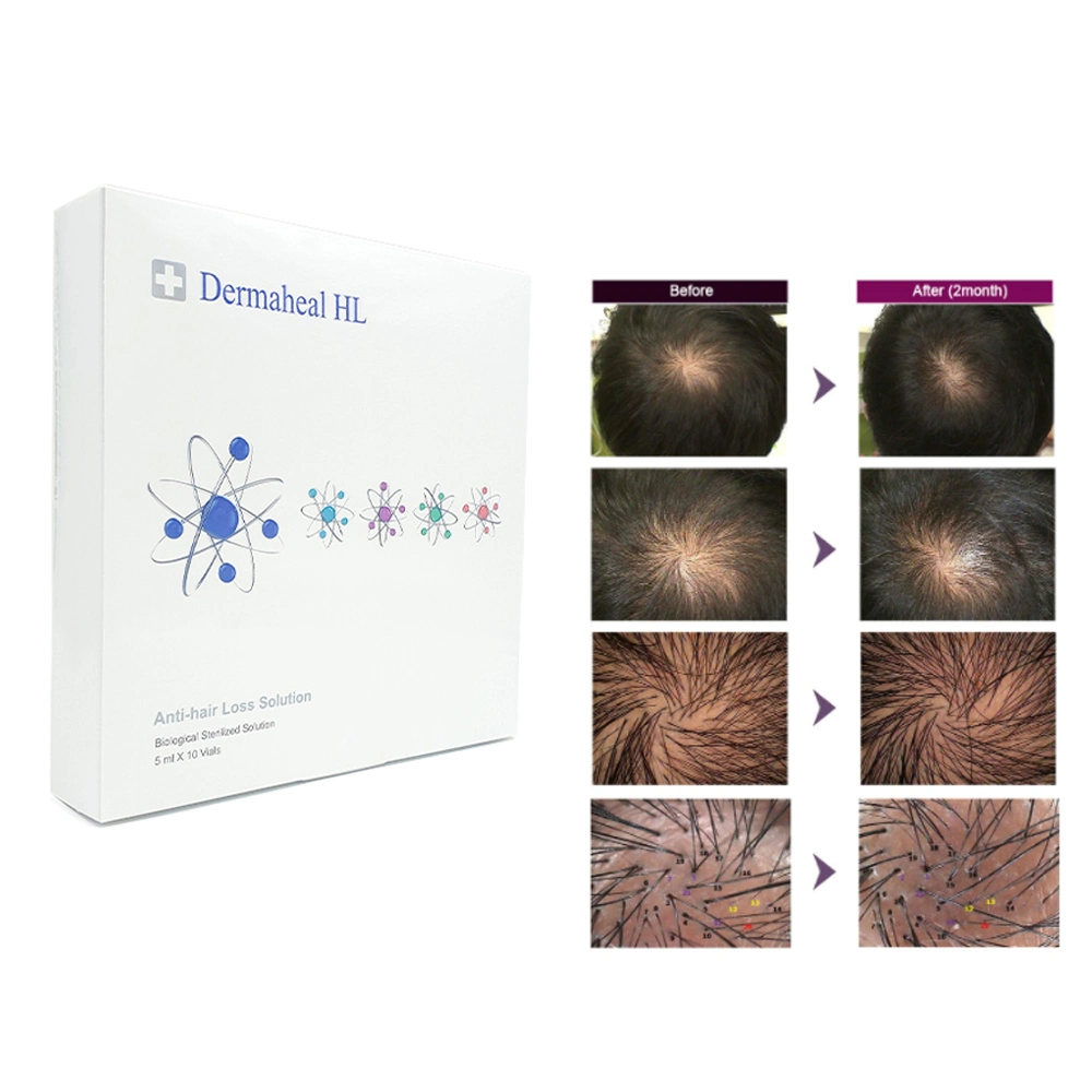 DERMAHEAL HL HAIR SOLUTION